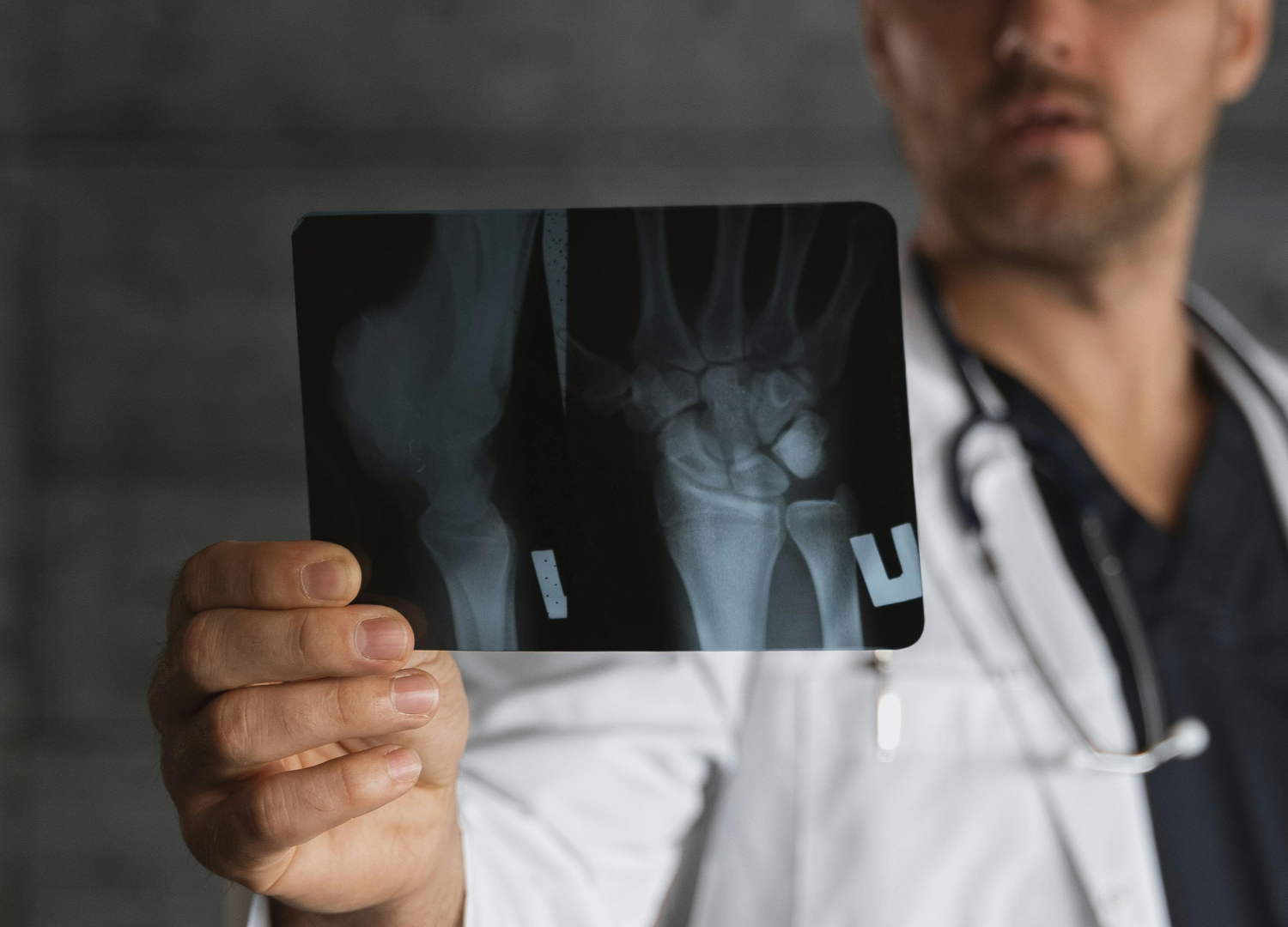 Zabiegi ortopedyczne